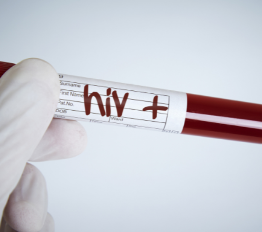 HIV